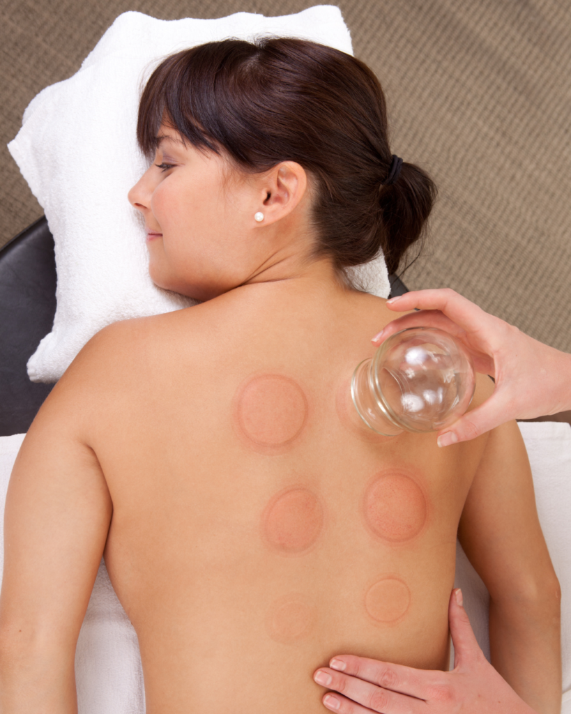 cupping-massage